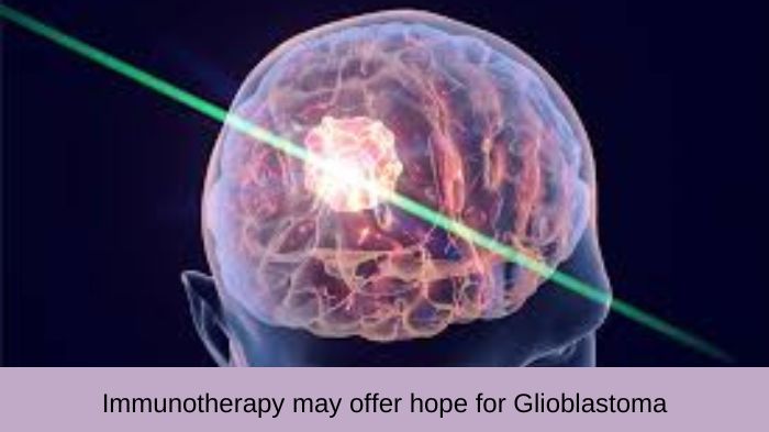 Immunotherapy may offer hope for Glioblastoma